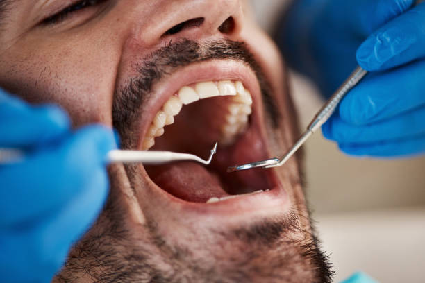 Best Emergency Dentist for Knocked-Out Tooth in Red Oak, IA